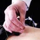 女性内分泌失调怎么办 针灸六穴位有效调理
