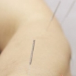 增强肺腑功能针灸 让你容光焕发