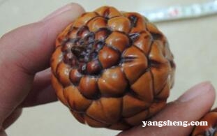 食物中毒：一家五口吃它全都被送进医院